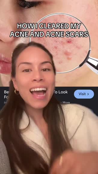 Video review of  Banish Kit 3.0  by social40