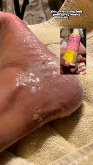 Video review of Mybiomiracle Exfoliating Foot Peeling Spray  by 6796daa9153fa604c76b2827