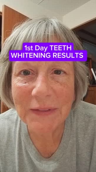 Video review of GuruNanda Teeth Whitening Strips - 16 Day Treatment with Non-Slip, Dry Strip Technology  by 67754eb2fb98e9af5e456a85
