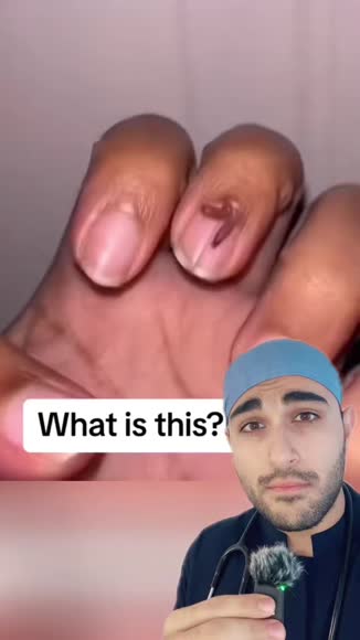 Video review of Clips Health  by drmaxmd43