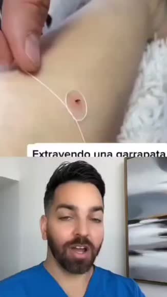Video review of Clips Health  by flipclip121472