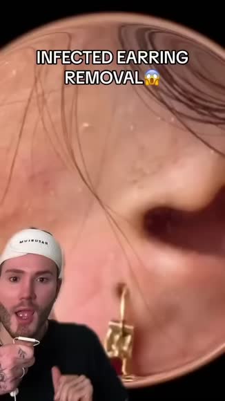 Video review of Clips Health  by mattrandon19
