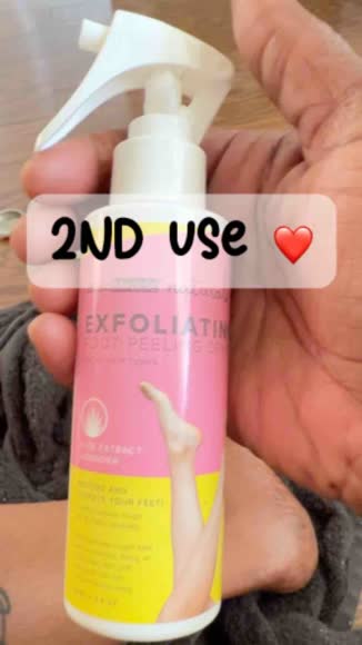 Video review of Mybiomiracle Exfoliating Foot Peeling Spray  by 66b29023a1bca35c9ddeceec