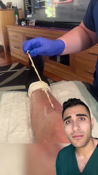 Video review of Clips Health  by drmaxmd43
