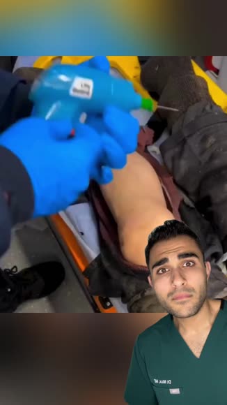 Video review of Clips Health  by drmaxmd43