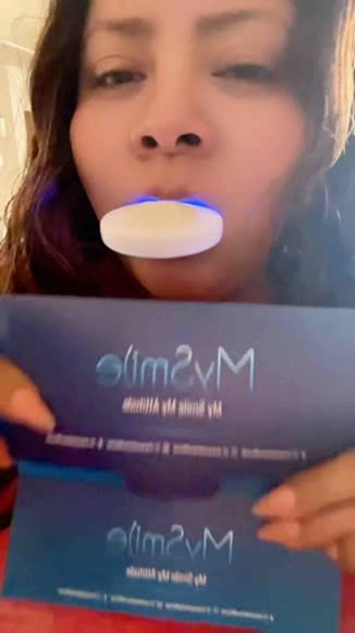 Video review of MySmile Original 5X Teeth Whitening Kit  by 678596aecf1903345c619196
