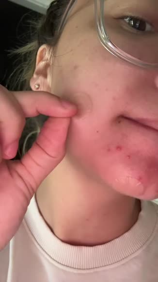 Video review of Patch RX Spot Patch  by info203456