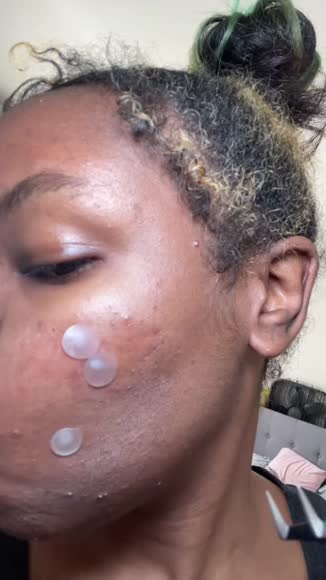 Video review of Patch RX Spot Patch  by info203456