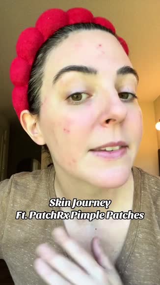 Video review of Patch RX Spot Patch  by info203456